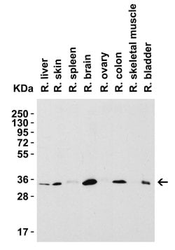 Invitrogen SIGLEC15 Polyclonal Antibody 100 &mu;g; Unconjugated:Antibodies,