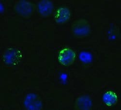 Invitrogen SARS-CoV-2 Spike Protein S1 Polyclonal Antibody 100 &mu;g; Unconjugated:Antibodies,