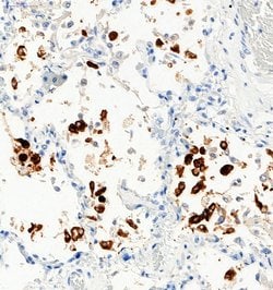 Invitrogen SARS-CoV-2 Spike Protein S1 Polyclonal Antibody 100 &mu;g; Unconjugated:Antibodies,