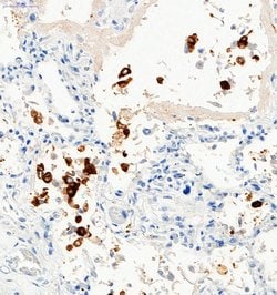 Invitrogen SARS-CoV-2 Spike Protein S1 Polyclonal Antibody 100 &mu;g; Unconjugated:Antibodies,