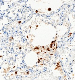 Invitrogen SARS-CoV-2 Spike Protein S1 Polyclonal Antibody 100 &mu;g; Unconjugated:Antibodies,