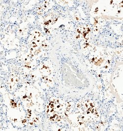 Invitrogen SARS-CoV-2 Spike Protein S1 Polyclonal Antibody 100 &mu;g; Unconjugated:Antibodies,