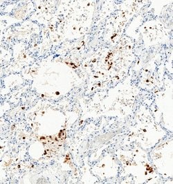 Invitrogen SARS-CoV-2 Spike Protein S1 Polyclonal Antibody 100 &mu;g; Unconjugated:Antibodies,