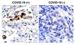 Invitrogen SARS-CoV-2 Spike Protein (RBD) Polyclonal Antibody 100 &mu;g;