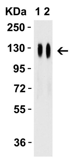 Invitrogen SARS-CoV-2 Spike Protein (RBD) Polyclonal Antibody 100 &mu;g;