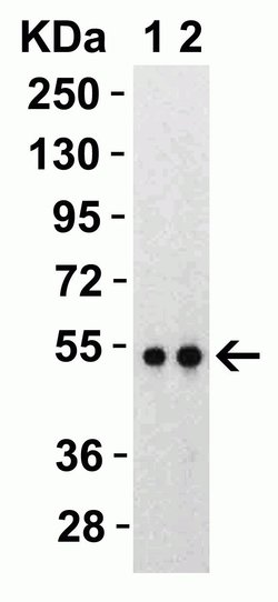 Invitrogen SARS-CoV-2 Nucleocapsid Polyclonal Antibody 100 &mu;g; Unconjugated:Antibodies,