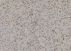 Invitrogen H3K27me3 Polyclonal Antibody 100 &mu;L | Buy Online | Invitrogen&trade; | Fisher Scientific