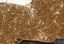 Invitrogen H3K27me3 Polyclonal Antibody 100 &mu;L | Buy Online | Invitrogen&trade; | Fisher Scientific