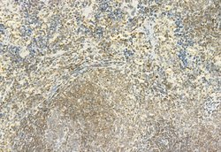 Invitrogen H3K27me3 Polyclonal Antibody 100 &mu;L | Buy Online | Invitrogen&trade; | Fisher Scientific