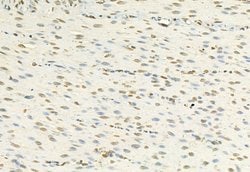 Invitrogen H3K27me3 Polyclonal Antibody 100 &mu;L | Buy Online | Invitrogen&trade; | Fisher Scientific