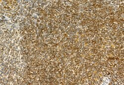 Invitrogen H3K27me3 Polyclonal Antibody 100 &mu;L | Buy Online | Invitrogen&trade; | Fisher Scientific