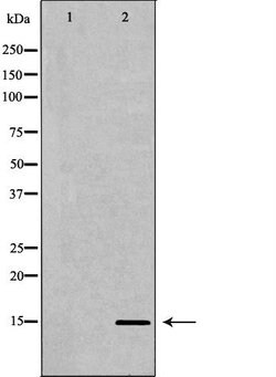Invitrogen H3K27me3 Polyclonal Antibody 100 &mu;L | Buy Online | Invitrogen&trade; | Fisher Scientific