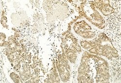 Invitrogen H3K4me3 Polyclonal Antibody 100 &mu;L; Unconjugated:Antibodies,