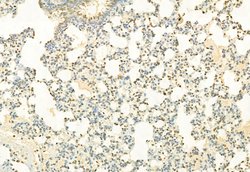 Invitrogen H3K4me3 Polyclonal Antibody 100 &mu;L; Unconjugated:Antibodies,