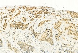 Invitrogen H3K4me3 Polyclonal Antibody 100 &mu;L; Unconjugated:Antibodies,