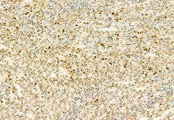 Invitrogen H3K4me3 Polyclonal Antibody 100 &mu;L; Unconjugated:Antibodies,