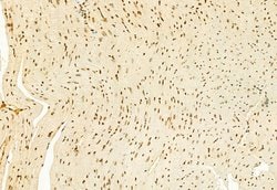 Invitrogen H3K4me3 Polyclonal Antibody 100 &mu;L; Unconjugated:Antibodies,