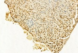 Invitrogen H3K4me3 Polyclonal Antibody 100 &mu;L; Unconjugated:Antibodies,
