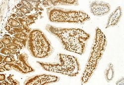 Invitrogen H3K4me3 Polyclonal Antibody 100 &mu;L; Unconjugated:Antibodies,