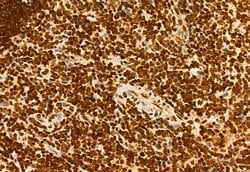 Invitrogen H3K4me3 Polyclonal Antibody 100 &mu;L; Unconjugated:Antibodies,