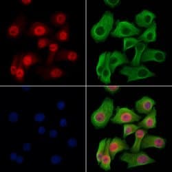Invitrogen Phospho-4EBP1 (Thr37, Thr46) Polyclonal Antibody 100 &mu;L;