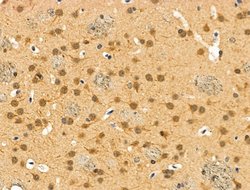Invitrogen Phospho-4EBP1 (Thr37, Thr46) Polyclonal Antibody 100 &mu;L;