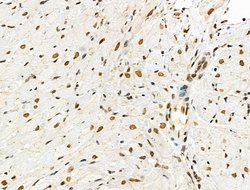Invitrogen Phospho-4EBP1 (Thr37, Thr46) Polyclonal Antibody 100 &mu;L;