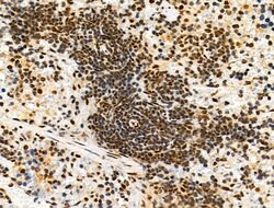 Invitrogen Phospho-4EBP1 (Thr37, Thr46) Polyclonal Antibody 100 &mu;L;