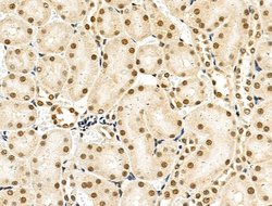 Invitrogen Phospho-4EBP1 (Thr37, Thr46) Polyclonal Antibody 100 &mu;L;