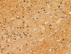 Invitrogen Phospho-4EBP1 (Thr37, Thr46) Polyclonal Antibody 100 &mu;L;