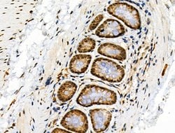 Invitrogen Phospho-4EBP1 (Thr37, Thr46) Polyclonal Antibody 100 &mu;L;