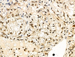 Invitrogen Phospho-4EBP1 (Thr37, Thr46) Polyclonal Antibody 100 &mu;L;