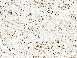 Invitrogen Phospho-4EBP1 (Thr37, Thr46) Polyclonal Antibody 100 &mu;L;