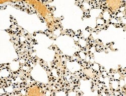 Invitrogen Phospho-4EBP1 (Thr37, Thr46) Polyclonal Antibody 100 &mu;L;