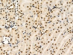 Invitrogen Phospho-4EBP1 (Thr37, Thr46) Polyclonal Antibody 100 &mu;L;