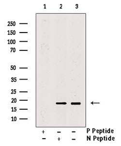 Invitrogen Phospho-4EBP1 (Thr37, Thr46) Polyclonal Antibody 100 &mu;L;