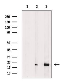 Invitrogen Phospho-4EBP1 (Thr37, Thr46) Polyclonal Antibody 100 &mu;L;