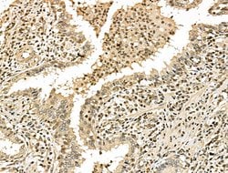 Invitrogen Phospho-53BP1 (Ser25, Ser29) Polyclonal Antibody 100 &mu;L | Buy Online | Invitrogen&trade; | Fisher Scientific