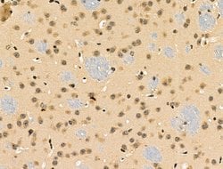 Invitrogen Phospho-53BP1 (Ser25, Ser29) Polyclonal Antibody 100 &mu;L | Buy Online | Invitrogen&trade; | Fisher Scientific