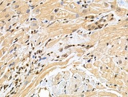 Invitrogen Phospho-53BP1 (Ser25, Ser29) Polyclonal Antibody 100 &mu;L | Buy Online | Invitrogen&trade; | Fisher Scientific