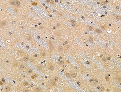 Invitrogen Phospho-53BP1 (Ser25, Ser29) Polyclonal Antibody 100 &mu;L | Buy Online | Invitrogen&trade; | Fisher Scientific