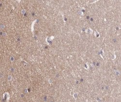 Invitrogen Phospho-ABL1/ABL2 (Tyr393, Tyr439) Polyclonal Antibody 100 &mu;L;