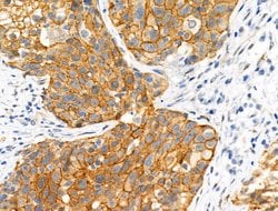 Invitrogen Phospho-Catenin alpha-1 (Ser655, Thr658) Polyclonal Antibody