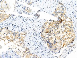 Invitrogen Phospho-Catenin alpha-1 (Ser655, Thr658) Polyclonal Antibody