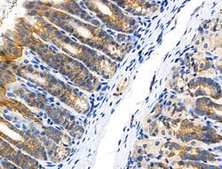 Invitrogen Phospho-Catenin alpha-1 (Ser655, Thr658) Polyclonal Antibody