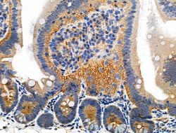 Invitrogen Phospho-Catenin alpha-1 (Ser655, Thr658) Polyclonal Antibody