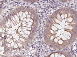 Invitrogen Phospho-AMPK alpha-1,2 (Thr172) Polyclonal Antibody 100 &mu;L;