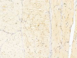 Invitrogen Phospho-AMPK alpha-1,2 (Thr172) Polyclonal Antibody 100 &mu;L;