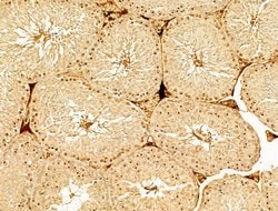 Invitrogen Phospho-AMPK alpha-1,2 (Thr172) Polyclonal Antibody 100 &mu;L;