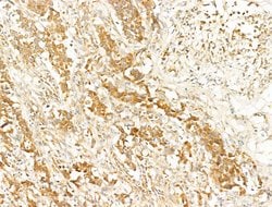 Invitrogen Phospho-AMPK alpha-1,2 (Thr172) Polyclonal Antibody 100 &mu;L;